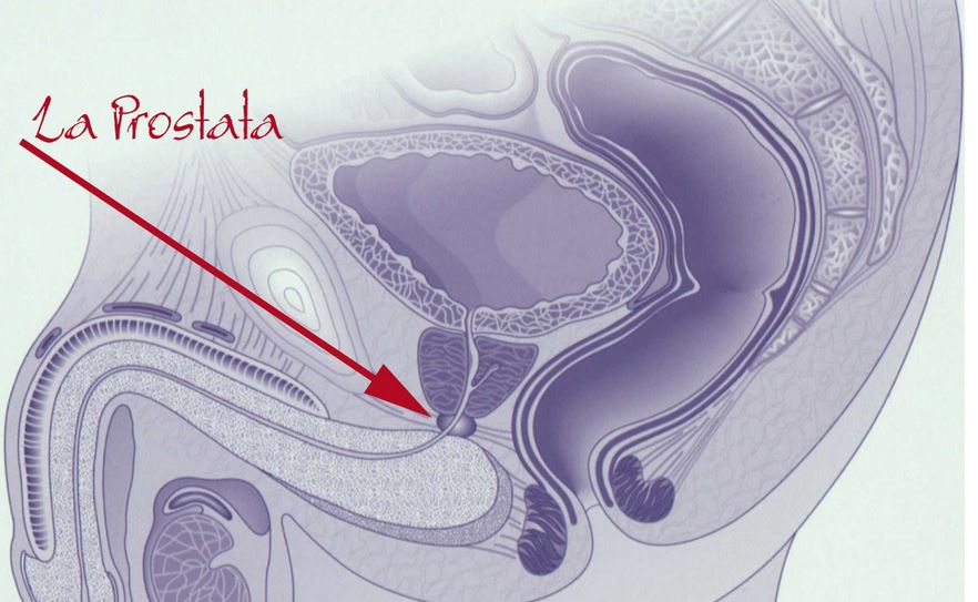 Tratament Pentru Prostata Inflamata. Prostatitis Durch E Coli