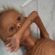 Somalia. A Baidoa 230 bambini morti per malnutrizione