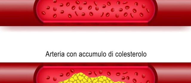 Salute. Colesterolo killer silenzioso: 40% italiani lo sottovaluta