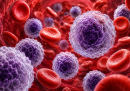 Tumori del sangue negli anziani, il caregiver diventa centrale nelle cure: presentato al Senato il nuovo policy paper